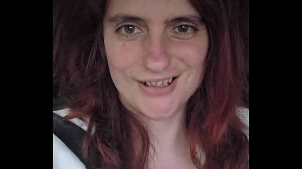 Chloecoquine  update 20  Aug 10 2024