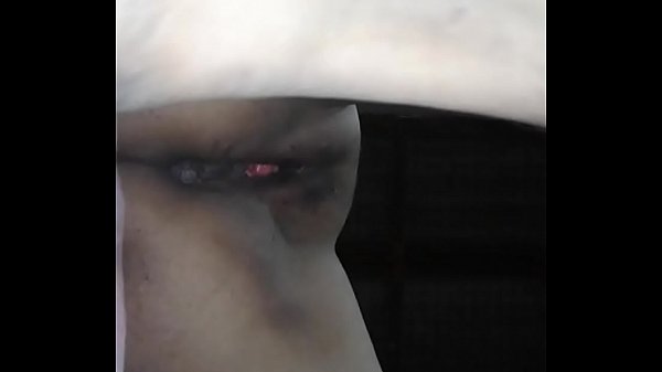 20161106 104024