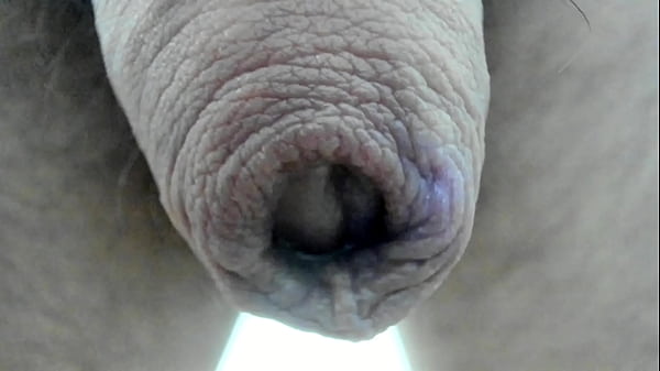 My foreskin superclose